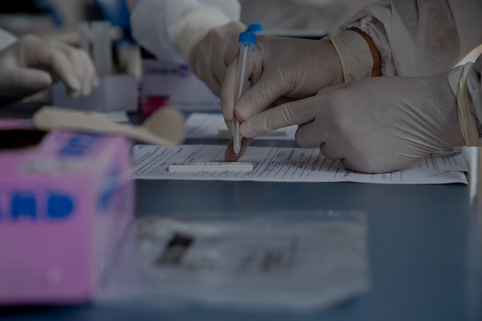É possível fazer teste de carga viral para reduzir o período de janela