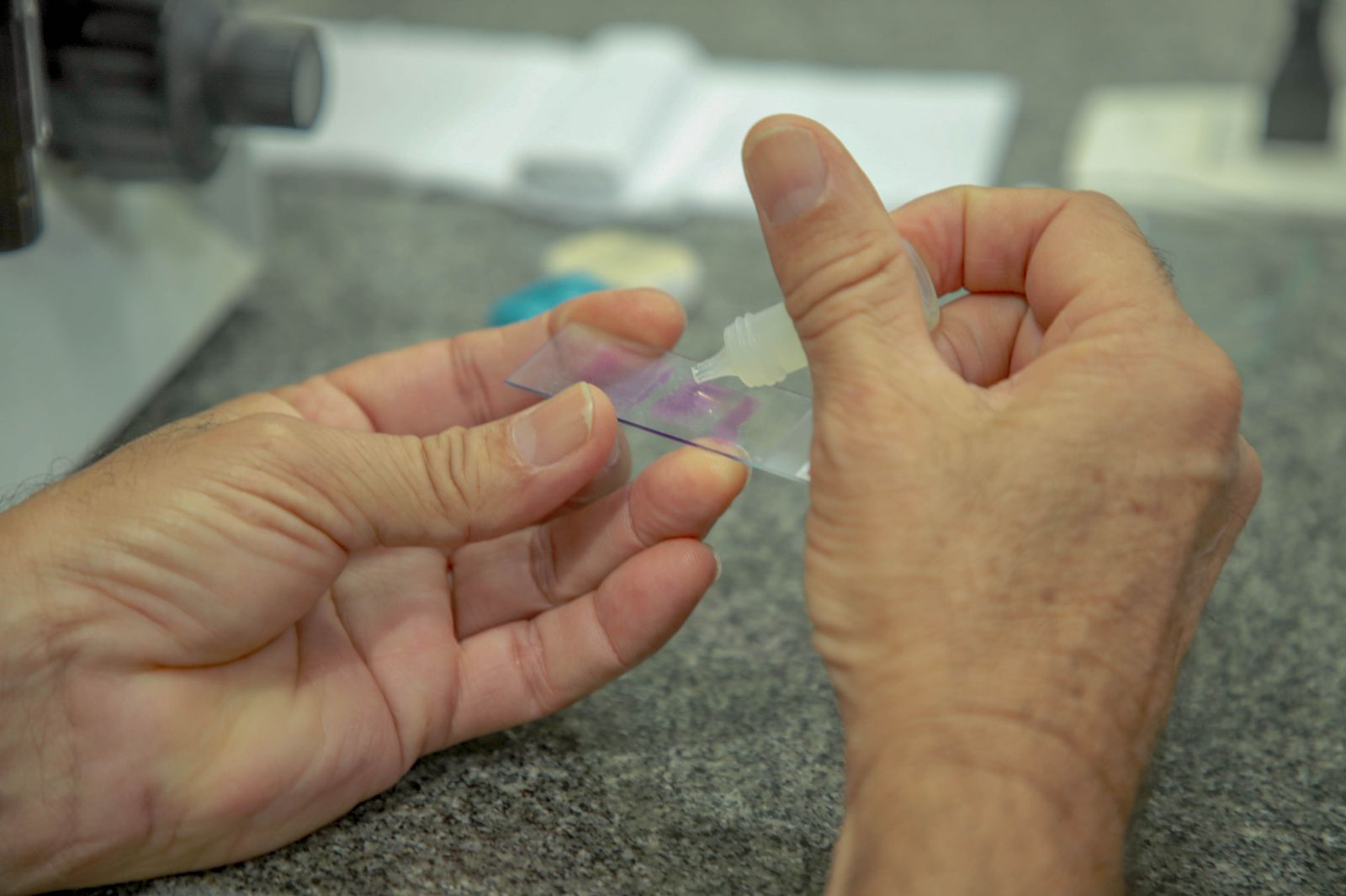 Malária vivax é a que tem maior incidência em todo o país